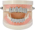 JINAO Grillz Diamond Grills for Your Teeth for Men Women 18K Gold Plated Iced Out Macro Pave Cubic Zirconia Mouth Grill with Extra Molding Bars In...