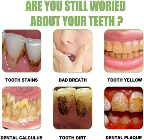 20Pcs Tlopa Ampoule Tooth Serum, Ampoule Essence Toothpaste, Teeth Toothpaste Serum, Solve All Oral Problems....