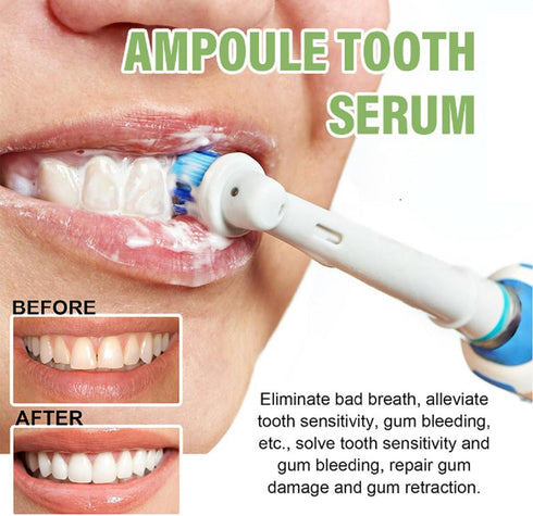 20Pcs Tlopa Ampoule Tooth Serum, Ampoule Essence Toothpaste, Teeth Toothpaste Serum, Solve All Oral Problems....