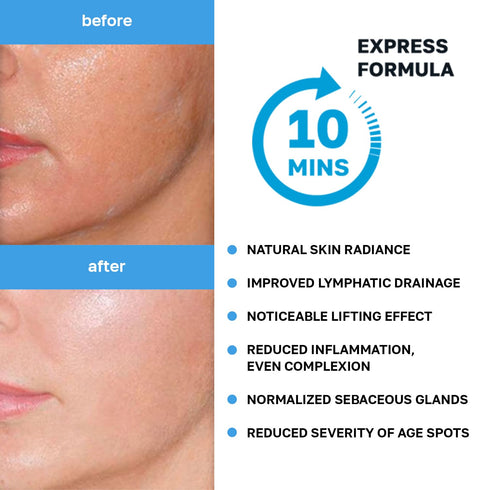 Name Skin Care Korean Carboxy CO2 Therapy Face & Neck Mask Set of 2 - Hydrating Oxygen Carboxytherapy Skincare Sheet Masks - Moisturizing Anti Agi...