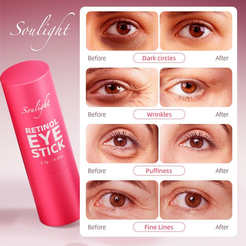 Retinol Eye Stick, Anti-Aging Eye Cream, Skincare for Wrinkles, Dark Circles, Puffiness - Retinol Eye Balm Moisturizes, Softens& Nourish Skin...