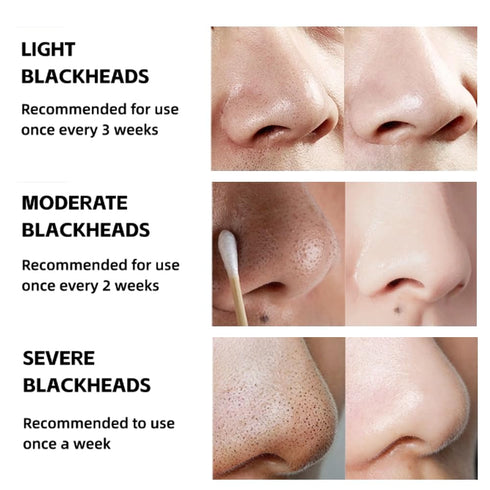 Blackhead Removal Mask 120ML Pull-Off Bamboo Charcoal Mask deeply cleans blackhead dirt and purifies pores for men and women(4.23 fl.oz)...