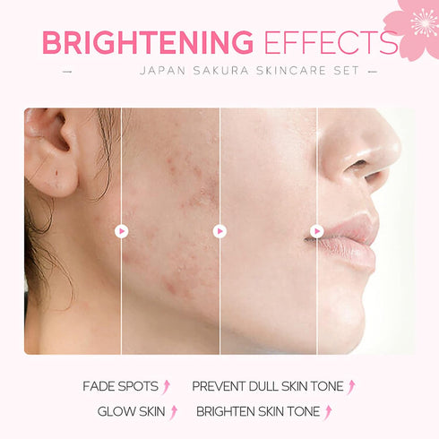 Skin Care Set - Women Gift Sets - Sakura Skin Care Sets & Kits - Gift Set with Cleanser,Toner,Serum,Eye Cream,essence Serum - Beauty Products For ...