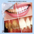 Nano Physical Teeth Cleaning Stick, Teeth Whitening, Cleaning Teeth Smoke Stains, Tartar Stains, Home Oral Care Whitening Teeth Kit, 1+10 Pcs (wit...