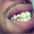 2 Pieces 14K Plated Gold Grillz Hip Hop Top Tooth Single Grill Cap for Teeth Mouth...