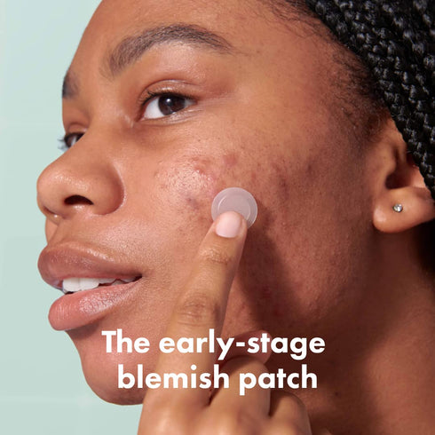 Mighty Patch Micropoint™ for Blemishes from Hero Cosmetics - Hydrocolloid Acne Spot Treatment Patch for Early Stage Zits and Hidden Pimples, 395 P...