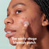 Mighty Patch Micropoint™ for Blemishes from Hero Cosmetics - Hydrocolloid Acne Spot Treatment Patch for Early Stage Zits and Hidden Pimples, 395 P...