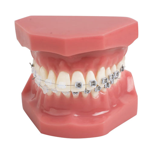 TM-208 Demonstration Orthodontic Model Teeth Teach Study Tools with Metal and Ceramic Bracket(Red)...