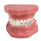 TM-208 Demonstration Orthodontic Model Teeth Teach Study Tools with Metal and Ceramic Bracket(Red)...