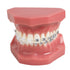 TM-208 Demonstration Orthodontic Model Teeth Teach Study Tools with Metal and Ceramic Bracket(Red)...
