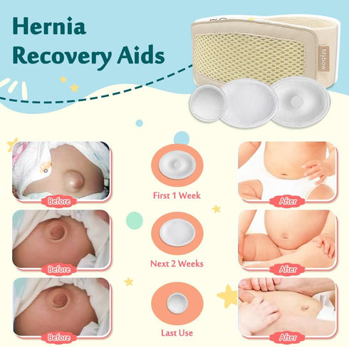 Mybow Umbilical Hernia Belt Baby, Infant Belly Button Band, Umbilical Cord Cover for Newborn Abdominal Binder, Hernia Support Truss, Belly Button ...