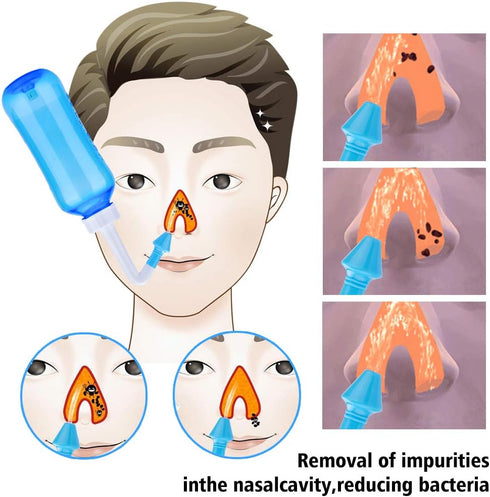 Carllg Neti Pot - Nasal Irrigation Wash Bottle with Sinus Rinse Salt for Adult & Kid (300ml Bottle with 30 Salt Packets)...