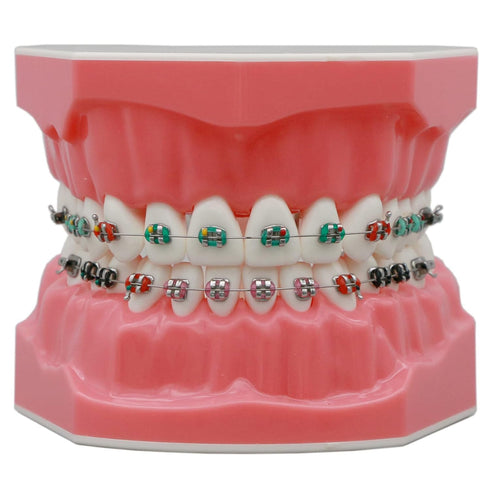 Orthodontic Model Dental Models 1:1 Standard Typodont Teeth Model M7010-2 Demo Teach Study with Archwire Ligature Ties Metal Brackets Buccal Tubes...