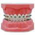 Orthodontic Model Dental Models 1:1 Standard Typodont Teeth Model M7010-2 Demo Teach Study with Archwire Ligature Ties Metal Brackets Buccal Tubes...