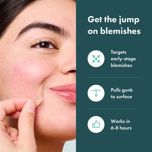 Mighty Patch Micropoint™ for Blemishes from Hero Cosmetics - Hydrocolloid Acne Spot Treatment Patch for Early Stage Zits and Hidden Pimples, 395 P...