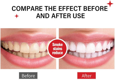 Sp-6 Ultra Whitening, Sp 6 Toothpaste 2pcs?probiotics whitening Toothpaste,Deep Cleaning Care Toothpaste,Fresh Breath Toothpaste Brightening & Sta...