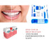 Portable Orthodontic Oral Care Kit - 2Pack - Travel Kit for Patients, Interdental Brushing Wax Floss Toothbrush Cleaning(Purple & Blue)...