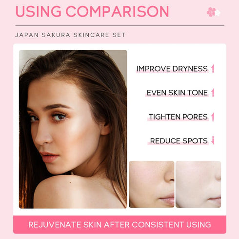 Sakura Skincare Gift Set, Skin Daily Care Travel Kit with Cleanser, Toner, Serum, Eye Cream, Face Cream for Women Girls (5pcs)...