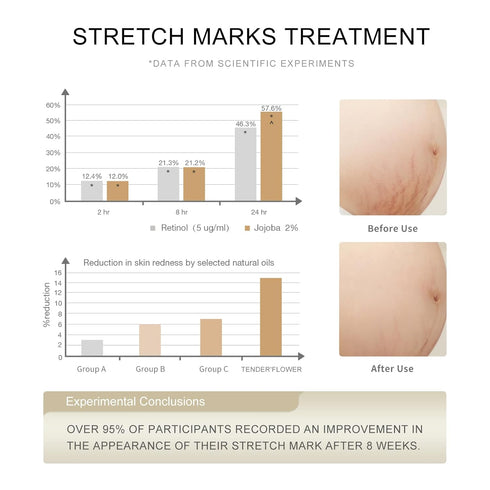 TENDER'FLOWER Stretch Mark Oil, body oil for Pregnancy,belly oil, belly abdominal Serum Skin Care,Moisturizing Dry Skin, Tender & Softening 3.7OZ...