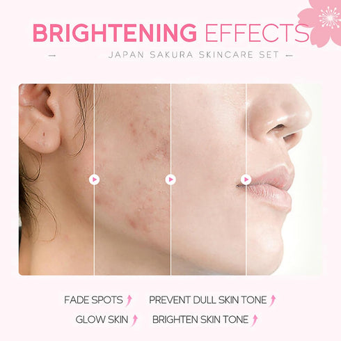 Skincare Gifts For Teenage Girls,Cherry Blossom Skincare Sets,Facial kit,Pamper Sets For Women Gifts,Skin Care Sets & Kits (SetA)...