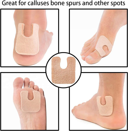48 Pieces U Shaped Felt Callus Pads Metatarsal Pads Forefoot Foot Pads Pain Relief Foot Cushion Keep Protecting Calluses from Rubbing on Shoes Adh...