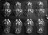 Life of the Party Frog A126 Chocolate Candy Mold with Instructions...