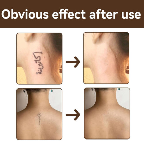 Tattoo Concealer, Skin Concealer, Tattoo Cover Up Makeup, Waterproof,Skin Scar Dark Spots Birthmark Concealer, Tattoo Cover Up Makeup, Use on Body...