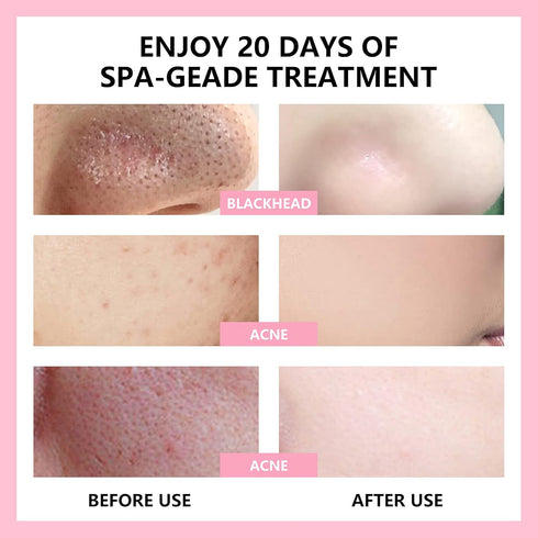 Strawberry Face Mask Clay Mask Cleansing Face Mask for Blackheads and Pores, Pink Clay Mask, Mask for Face Skin Care for Blackhead Remover Mask, C...