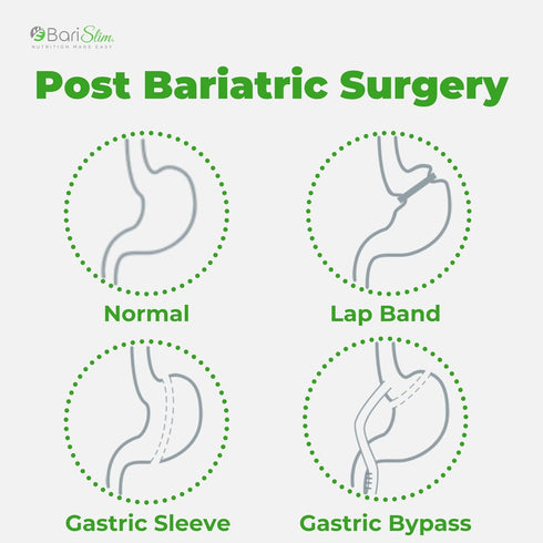 Bariatric Vitamin Biotin Gummies - Specially Formulated Gummy Vitamin for Patients After Weight Loss Surgery - Easy to Digest and Great Tasting Fr...