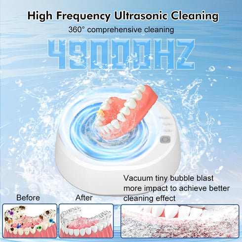 Ultrasonic Cleaner Retainer Cleaning Machine, 2024 Upgraded 40W 340ML 49KHz Jewelry Cleaner Ultrasonic Machine, Professional Dental Cleaner for De...