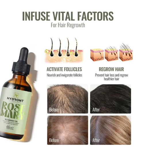 Hydront Rosemary Oil, 2 Fl Oz, Hair Growth Oil, Paraben-Free, Scalp and Hair Strengthening Oil for All Hair Types...