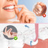 Aligner Removal Tool, 5 Retainer Remover Tool, Invisible Braces Removal Tools, Suitable for Removing Braces, Trays, Retainers, Dentures and Aligne...