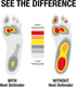 Heel Cups Alternative for Plantar Fasciitis by Heel Defender, Achilles Tendonitis Relief, Comfortable Shoe Inserts for Women & Children Designed b...