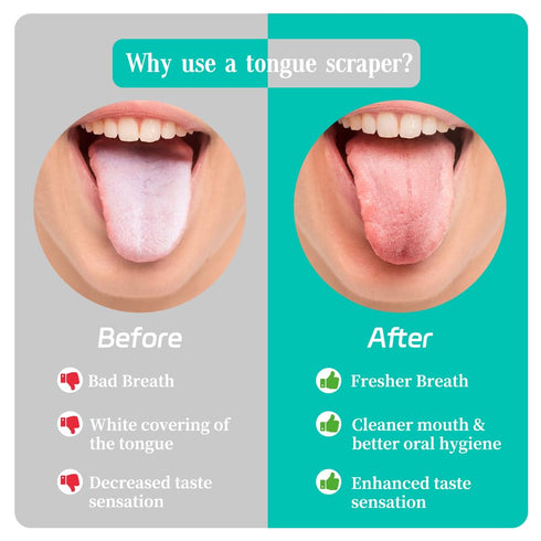 6 Pack Tongue Scraper for Adults, 100% Stainless Steel, Tongue Scrubber, Easy to Use, Tongue Cleaner for Oral Care & Hygiene, Reduce Bad Breath...