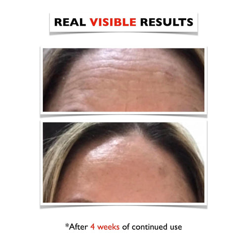 Big 2 Fl Oz. Vitamin C Face Serum. Anti Aging Dark Spot Remover Facial Serum. All-in-One Brightening Vitamin C, Hyaluronic Acid & Vit E Skin Care ...