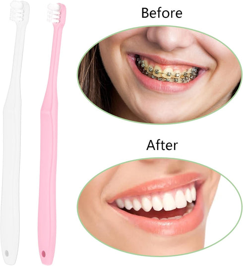 2 Pieces Tuft Toothbrush Small Head End Tapered Wisdom Interdental Interspace Nursing Soft Tiny Toothbrush Orthodontic Gum Periodontal Dental Prod...