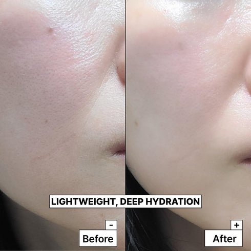 PLUSREAL Spring Water + Hyaluronic Acid Cream?Lightweight AM/PM Deep Hydrating Face Moisturizer for Sensitive Skin?Fragrance Free, Parabens Free, ...