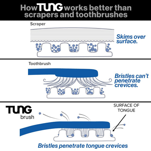 Peak Essentials | TUNG Natural Brush & Gel Kit | Tongue Cleaner for Adults | Tongue Scraper to Fight Bad Breath and Halitosis | Mouth Odor Elimina...