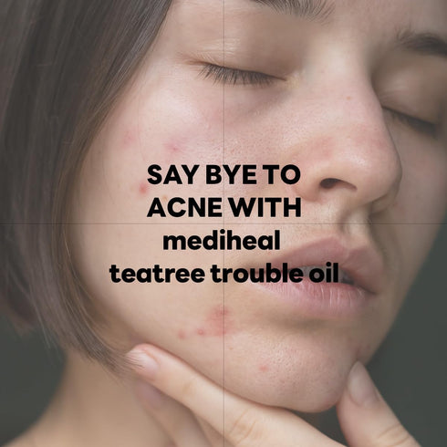 Mediheal Teatree Trouble Calming Oil (0.33 fl oz), Quick Calming and Deep Hydration Oil with Control Excess Oil for Sensitive Skin Type...