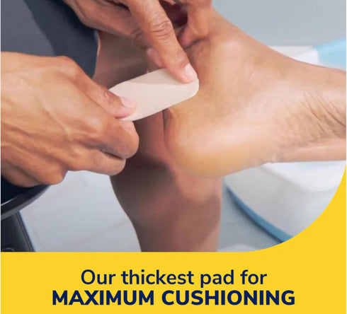 Dr. Scholl's Molefoam Padding 2 Each (Pack of 4)...