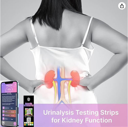 Wellness Urine Home Test Strips with Mobile App. Home Kidney Test Illustrated of Your Health Based on pH, Keto, Protein end More. UTI test strips ...