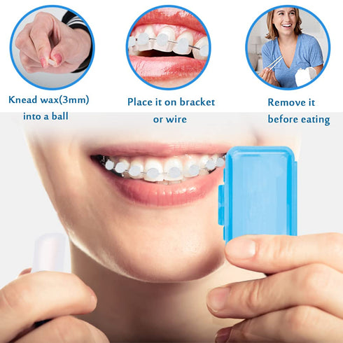 Braces Wax for Teeth 6 Pack Dental Care Orthodontic Wax for Braces Wearer (6 Pack, Colorful)...