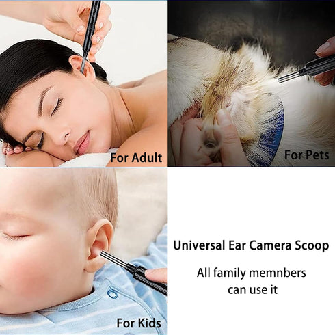 Ear Wax Removal with Camera - High-Definition Ear Health Monitor for iPhone, iPad & Android Phones...