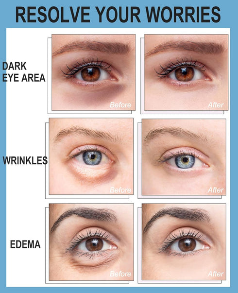 Collagen Under Eye Patches for Dark Circles and Puffiness Gold Color, Collagen Eye Masks Skincare for Puffy Eyes Gold Color...