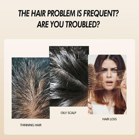 Onion Oil for Hair Growth Organic,Rosemary Hair Growth Oil Enriched with Rosemary, Onion Oil,Black Seed Oil Control Hair Loss, Promotes Hair Growt...