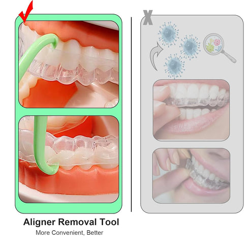 Aligner Removal Tool, Portable Clear Aligner Removal Tool for Invisalign Removable Retainers, Braces, Aligners Remove Hook Pull Tool (8PCS)...
