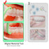 Aligner Removal Tool, Portable Clear Aligner Removal Tool for Invisalign Removable Retainers, Braces, Aligners Remove Hook Pull Tool (8PCS)...