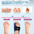 INDEEMAX Bunion Corrector for Women Men, Adjustable Orthopedic Bunion Splint, Non-Surgical Big Toe Hammer Straightener for Day & Night Hallux Valg...
