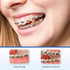 JMU Orthodontic Elastics 3/8 Heavy, 300 Pack Orthodontic Rubber Bands, Intraoral Elastic Bands Latex Dental Rubber Bands Made in USA...