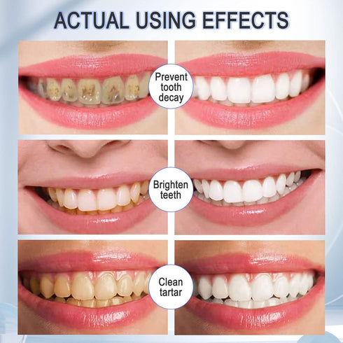 2 Packs Foam Toothpaste, Whitening Toothpaste, Baking Soda Toothpaste, Ultra-fine Mousse Foam Deeply Cleaning Gums, for Great Oral Care & Whitenin...